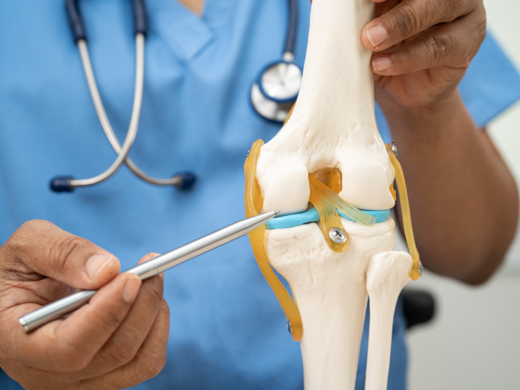 10 astuces naturelles pour améliorer votre santé articulaire